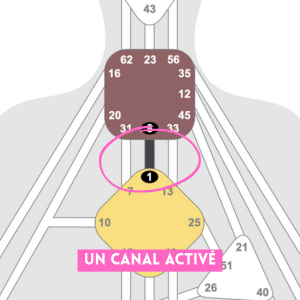 Canal